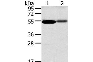 Western Blot analysis of Human kidney pericarcinous and kidney cancer tissue using SLC17A1 Polyclonal Antibody at dilution of 1:200 (SLC17A1 Antikörper)