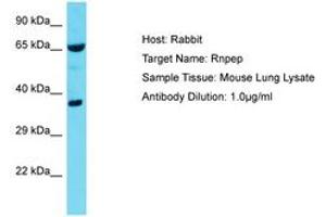 Image no. 1 for anti-Arginyl Aminopeptidase (Aminopeptidase B) (RNPEP) (AA 329-378) antibody (ABIN6750383)