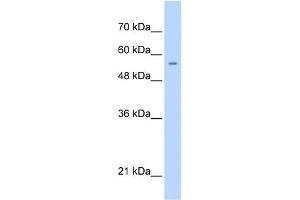 WB Suggested Anti-PGS1 Antibody Titration:  0. (PGS1 Antikörper  (C-Term))