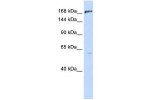 WB Suggested Anti-ABCC1 Antibody Titration:  0. (ABCC1 Antikörper  (Middle Region))