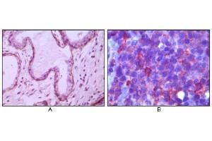 Immunohistochemical analysis of paraffin-embedded human breast ductal myoepithelium (A) and lymph tissue (B), showing cytoplasmic (A) and membrane (B) localization using CD10 mouse mAb with DAB staining (A) and AEC staining (B). (MME Antikörper)