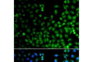 Immunofluorescence analysis of A549 cells using LHX6 Polyclonal Antibody (LHX6 Antikörper)
