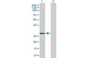 Western Blot analysis of ARHGDIA expression in transfected 293T cell line by ARHGDIA MaxPab polyclonal antibody. (ARHGDIA Antikörper  (AA 1-204))