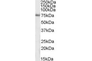 Western Blotting (WB) image for anti-Inositol-Trisphosphate 3-Kinase C (ITPKC) (Internal Region) antibody (ABIN2464190) (ITPKC Antikörper  (Internal Region))