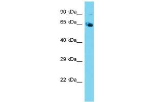 Host: Rabbit  Target Name: Nploc4  Sample Tissue: Mouse Testis lysates  Antibody Dilution: 1. (NPLOC4 Antikörper  (N-Term))