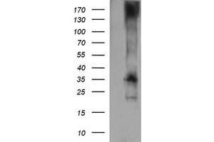 Western Blotting (WB) image for anti-T-cell surface glycoprotein CD1c (CD1C) antibody (ABIN2670658) (CD1c Antikörper)