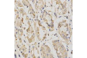Immunohistochemistry (Paraffin-embedded Sections) (IHC (p)) image for anti-serine/threonine Kinase 11 (STK11) (AA 134-433) antibody (ABIN3022973)