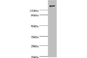 Western blot All lanes: ROCK2 antibody at 2 μg/mL + Rat brain tissue Secondary Goat polyclonal to rabbit IgG at 1/10000 dilution Predicted band size: 161 kDa Observed band size: 161 kDa (ROCK2 Antikörper  (AA 1109-1388))