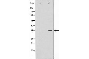 Western blot analysis on LOVO cell lysate using ATPBD3 Antibody，The lane on the left is treated with the antigen-specific peptide. (ATPBD3 Antikörper  (C-Term))