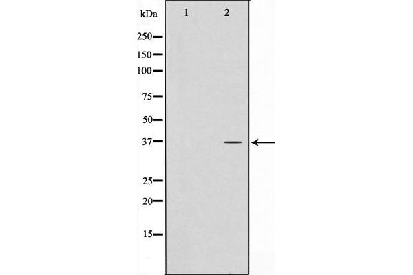 ATPBD3 anticorps  (C-Term)