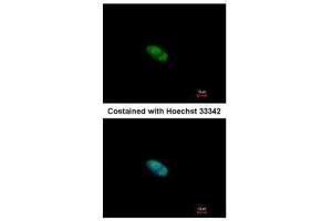 ICC/IF Image Immunofluorescence analysis of paraformaldehyde-fixed HeLa, using ZNF148, antibody at 1:500 dilution. (ZNF148 Antikörper  (N-Term))