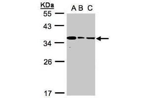 WB Image Sample(30 ug whole cell lysate) A:293T B:A431, C:H1299 12% SDS PAGE antibody diluted at 1:1000 (BPGM Antikörper)