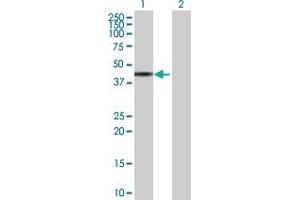 Western Blot analysis of ZNF331 expression in transfected 293T cell line by ZNF331 MaxPab polyclonal antibody. (ZNF331 Antikörper  (AA 1-463))