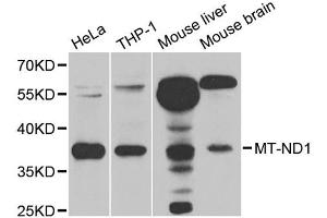 Western blot analysis of extracts of various cell lines, using MT-ND1 antibody. (MT-ND1 Antikörper)