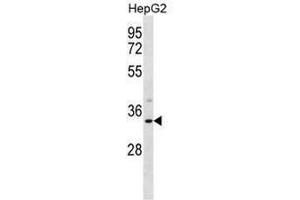 SULT1A3 Antibody (Center) western blot analysis in HepG2 cell line lysates (35µg/lane). (SULT1A3/1A4 Antikörper  (Middle Region))