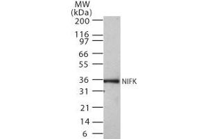 Western Blotting (WB) image for anti-MKI67 FHA Domain-Interacting Nucleolar Phosphoprotein (MKI67IP) (AA 100-200) antibody (ABIN208012) (NIFK Antikörper  (AA 100-200))