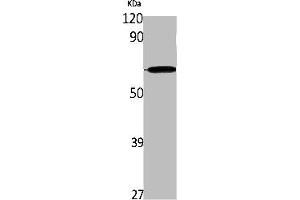 Western Blot analysis of K562 cells using IL-28Rα Polyclonal Antibody (IL28RA Antikörper  (Internal Region))