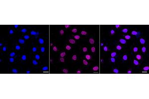 anti-Emerin (EMD) antibody
