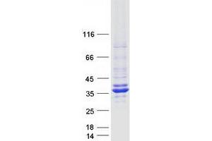 Western Blotting (WB) image for Enoyl Coenzyme A Hydratase 1, Peroxisomal (ECH1) protein (Myc-DYKDDDDK Tag) (ABIN2719918)