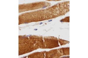 Immunohistochemical analysis of TITIN in Human skeletal muscle tissue sections(IHC-P - paraformaldehyde-fixed, paraffin-embedded sections). (Titin Antikörper  (N-Term))