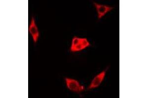 ABIN6273514 staining Hela cells by IF/ICC. (LGALS1/Galectin 1 Antikörper  (Internal Region))
