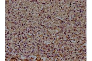 Immunohistochemistry (IHC) image for anti-CD14 (CD14) (AA 20-345) antibody (ABIN7160185)