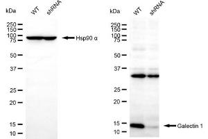 Western blotting analysis using galectin 1 antibody (ABIN7799241).