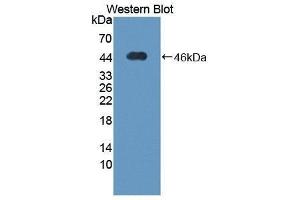 Western Blotting (WB) image for anti-Thioredoxin Interacting Protein (TXNIP) (AA 32-367) antibody (ABIN1871370) (TXNIP Antikörper  (AA 32-367))