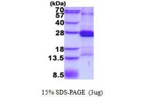 CD2 (CD2) protein (His tag)