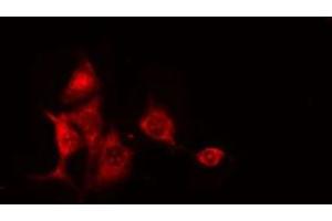 ABIN6275205 staining RAW264. (CEP97 Antikörper  (Internal Region))