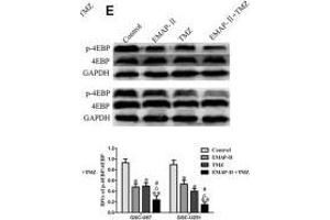EMAP-II in combination with TMZ induced GSCs autophagy through MACC1 inhibiting PI3K/AKT/mTOR signaling pathway. (eIF4EBP1 Antikörper  (C-Term))