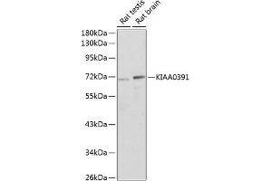 Western blot analysis of extracts of various cell lines, using KI antibody (ABIN6133342, ABIN6142843, ABIN6142845 and ABIN6220233) at 1:1000 dilution. (KIAA0391 Antikörper  (AA 314-583))