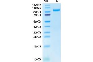 Cynomolgus HGFA (pro form) on Tris-Bis PAGE under reduced condition. (HGFA Protein (AA 34-650) (His tag))