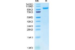 HGFA Protein (AA 34-650) (His tag)