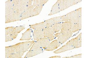 ABIN6259513 and ABIN6275914 at 1/100 staining Mouse muscle tissue by IHC-P. (Adenosine A3 Receptor Antikörper  (C-Term))