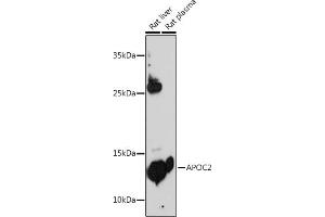 Western blot analysis of extracts of various cell lines, using  antibody (ABIN3022520, ABIN3022521, ABIN3022522 and ABIN6218875) at 1:500 dilution. (Apolipoprotein C-II Antikörper  (AA 1-101))