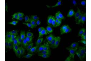 Immunofluorescence staining of HepG2 cells with ABIN7175220 at 1:100, counter-stained with DAPI. (TCIRG1 Antikörper  (Isoform 3))