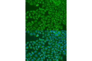 Immunofluorescence analysis of U2OS cells using FXR2 antibody. (FXR2 Antikörper  (AA 550-650))