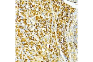 Immunohistochemistry of paraffin-embedded rat ovary using V antibody (ABIN6130774, ABIN6150046, ABIN6150047 and ABIN6224821) at dilution of 1:100 (40x lens). (VAMP1 Antikörper  (AA 1-96))