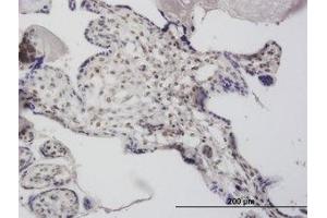 Image no. 4 for anti-Decapping Enzyme, Scavenger (DCPS) (AA 1-338) antibody (ABIN466201) (DCPS Antikörper  (AA 1-338))