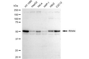Western blotting analysis using IRAK4 antibody (ABIN7799116).