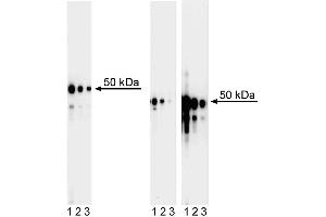 Western blot analysis of GATA3 in human T leukemia and mouse T helper cells. (GATA3 Antikörper)