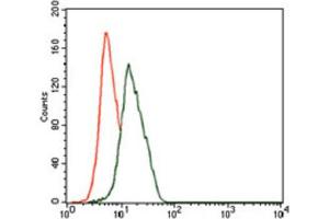 Immunohistochemical analysis of paraffin-embedded liver cancer tissues using ENO2 antibody with DAB staining. (ENO2/NSE Antikörper  (AA 251-433))