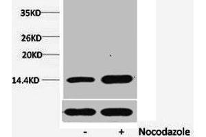 Western blot analysis of extracts from Hela cells, untreated (-) or treated, 1:5000. (HIST1H1A/HIST1H1C/HIST1H1D/HIST1H1E (pSer1) Antikörper)