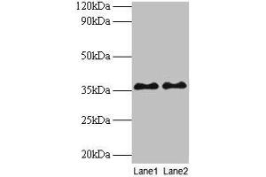 Western blot All lanes: SUPT3H antibody at 2 μg/mL Lane 1: Mouse brain tissue Lane 2: Colo320 whole cell lysate Secondary Goat polyclonal to rabbit IgG at 1/10000 dilution Predicted band size: 36, 38 kDa Observed band size: 36 kDa (SUPT3H/SPT3 Antikörper  (AA 1-328))