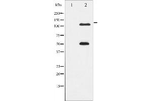 Western Blotting (WB) image for anti-Nuclear Factor of kappa Light Polypeptide Gene Enhancer in B-Cells 1 (NFKB1) (pSer337) antibody (ABIN6256276)