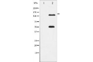 Western blot analysis of NF- kappaB p105/p50 phosphorylation expression in MDA-MB-435 whole cell lysates,The lane on the left is treated with the antigen-specific peptide.