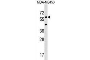 Western Blotting (WB) image for anti-Potassium Voltage-Gated Channel, Delayed-Rectifier, Subfamily S, Member 3 (KCNS3) antibody (ABIN2999385) (KCNS3 Antikörper)
