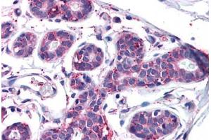 Human Breast: Formalin-Fixed, Paraffin-Embedded (FFPE) (MFI2 Antikörper  (N-Term))