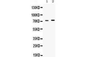 Western blot analysis of STIP1 expression in rat testis extract (lane 1) and MCF-7 whole cell lysates (lane 2). (STIP1 Antikörper  (C-Term))